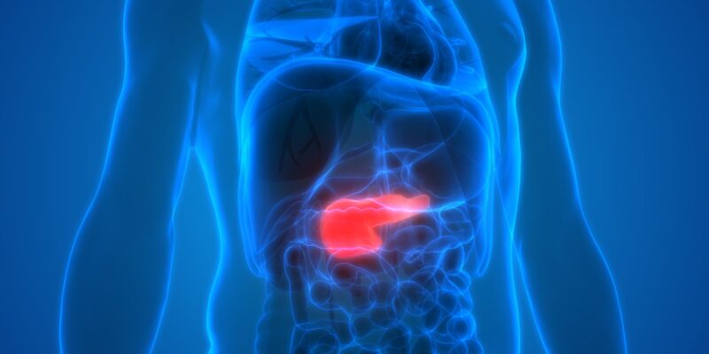 pancreatic cancer