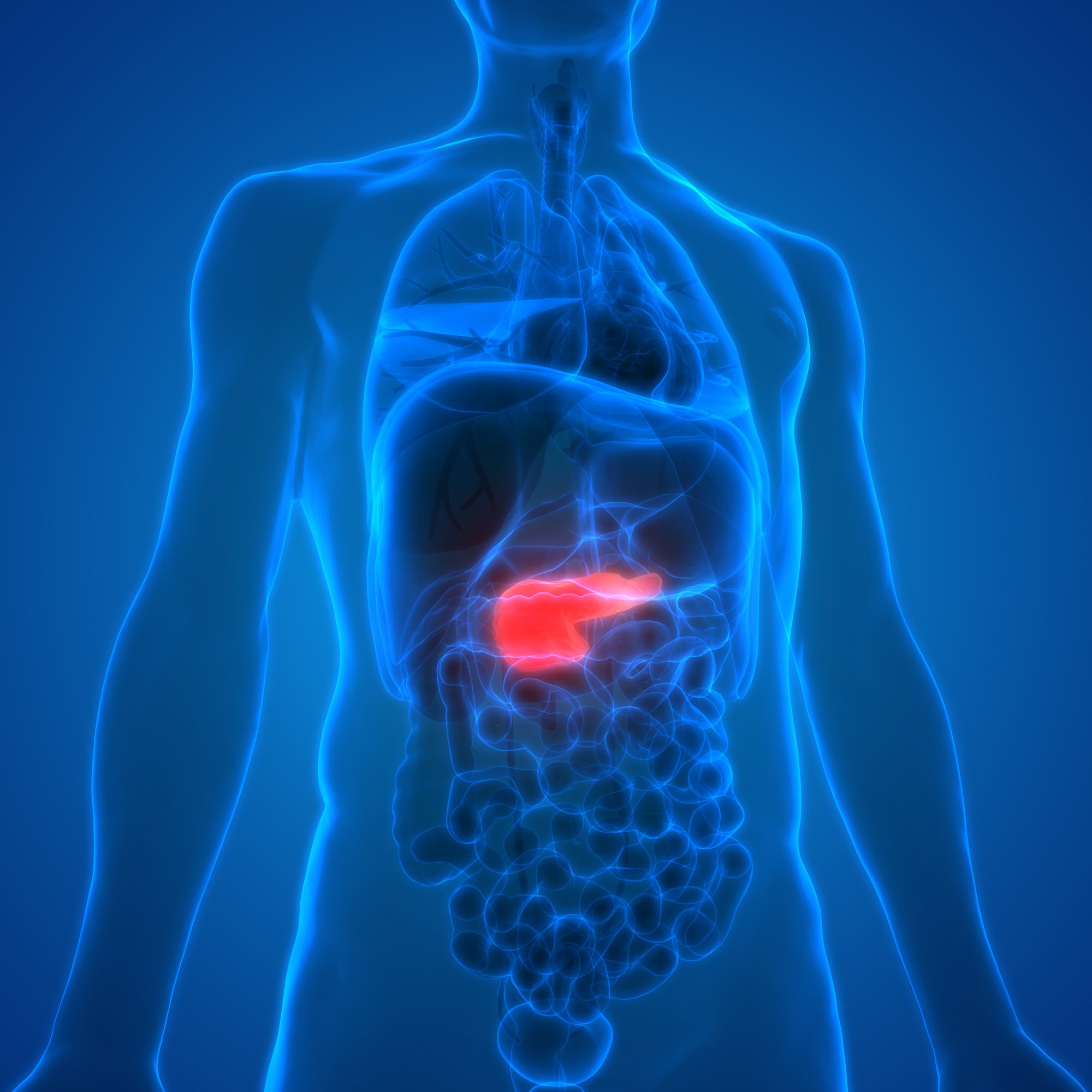 pancreatic cancer