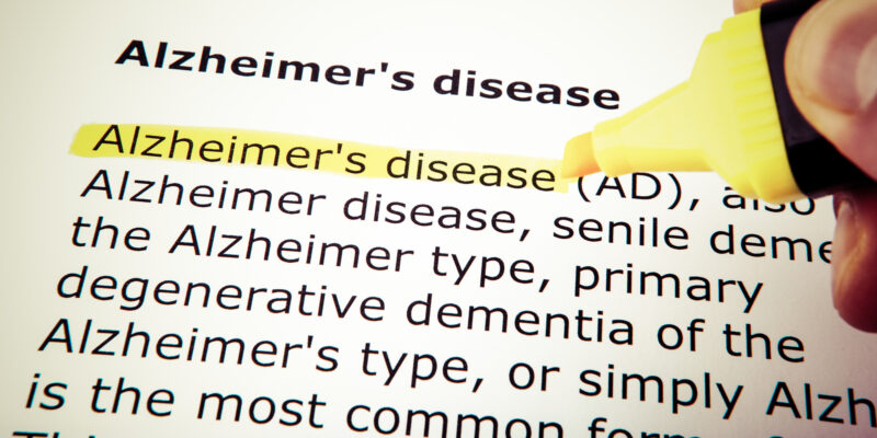 alzheimer's test