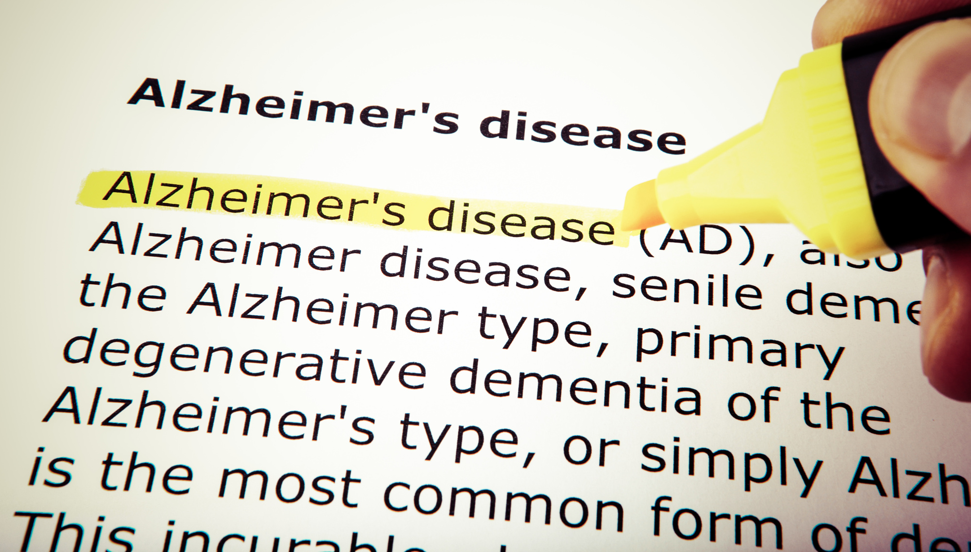 alzheimer's test